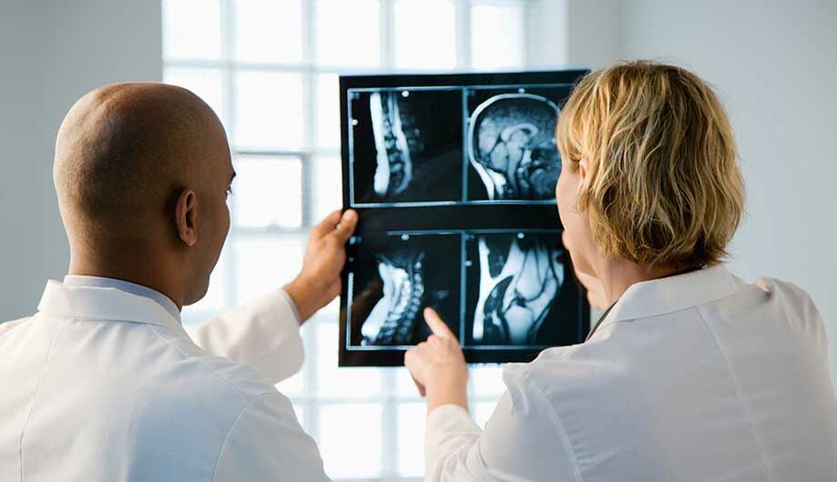 Diagnóstico de osteocondrose cervical a través de imaxes