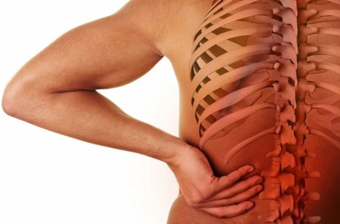 Osteocondrose de Lumbale