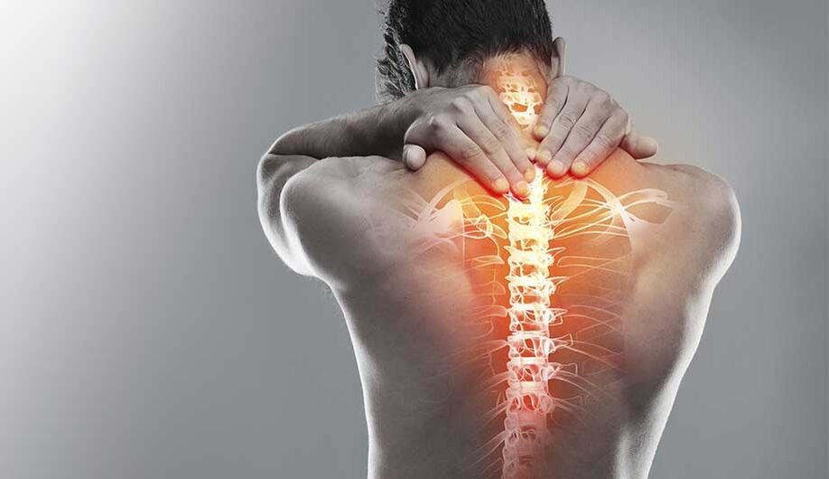 Osteocondrose do pescozo