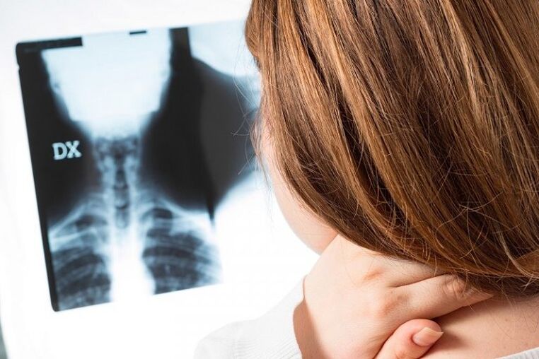 X -ray da rexión do cérvix