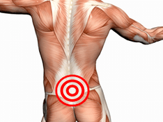 Síntomas e tratamento da osteocondrose lumbar