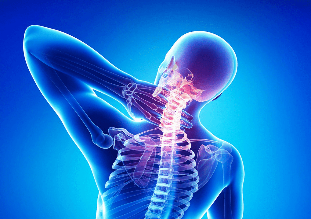 Osteocondrose da columna