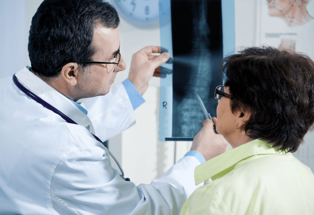 Un neurólogo diagnostica a osteocondrose mediante unha radiografía da columna vertebral