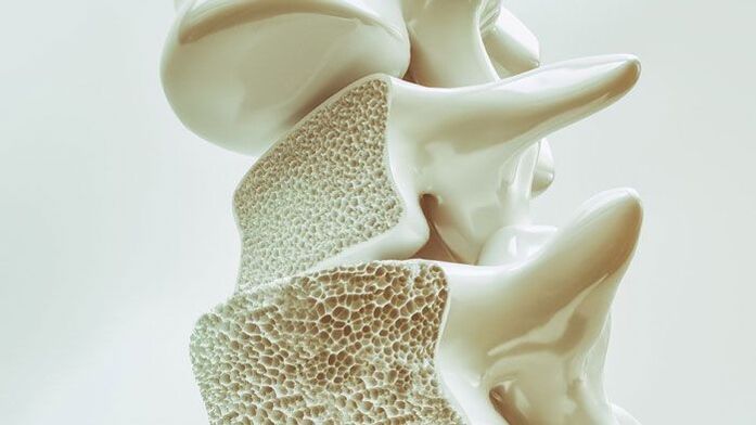 Modelo seccional da columna vertebral